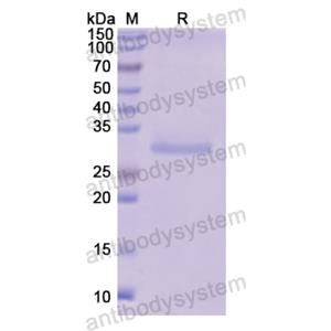 重組FUCA1蛋白,Recombinant Human FUCA1, N-His
