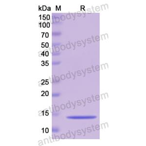 重組CSTB蛋白,Recombinant Human CSTB, N-His