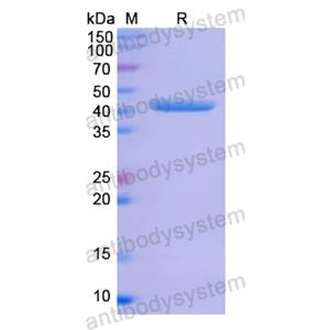 Recombinant Human ANXA1, N-His