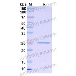 Recombinant Human APOB, N-His