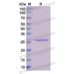 Recombinant Human TK1, N-His