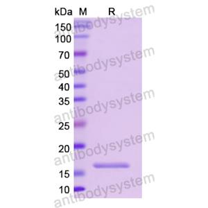 重组CD74蛋白,Recombinant Human CD74, N-His