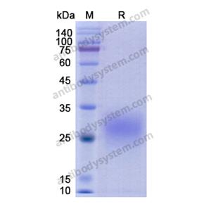 Recombinant Human CD74, C-His