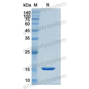 重組KRT1蛋白,Recombinant Human KRT1, N-His