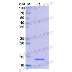 重组S100B蛋白,Recombinant Human S100B, N-His