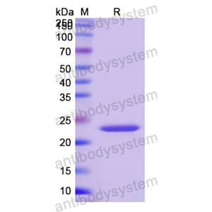 Recombinant Human VWF, N-His