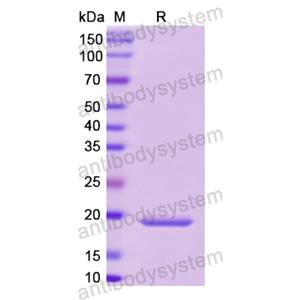 Recombinant Human SHBG, N-His