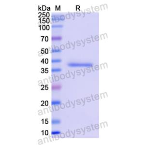 Recombinant Human GAPDH, C-His