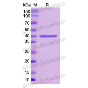 Recombinant Human CD340/ERBB2, N-His