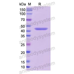 Recombinant Human TP53/p53, N-His