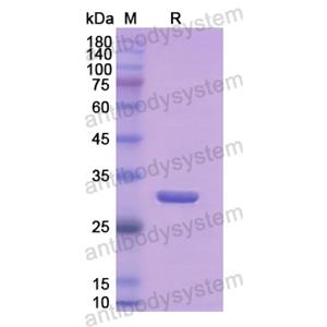 重组AMY2A蛋白,Recombinant Human AMY2A, N-His