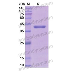 Recombinant Human ALDOB, N-His