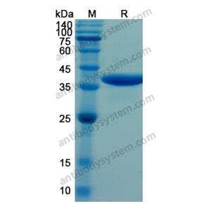 Recombinant Human ARG1, N-His