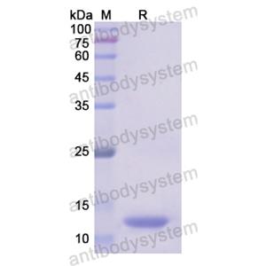 Recombinant Human ALDH2, N-His