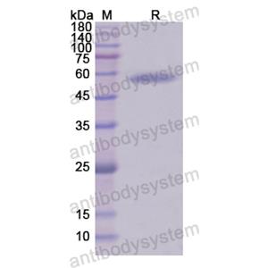 Recombinant Human CD18/ITGB2, N-GST