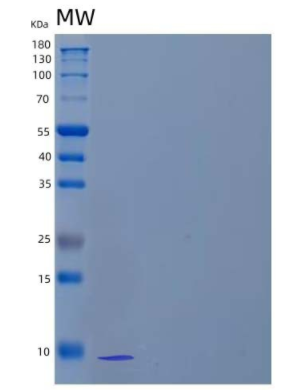 Recombinant Human cAMP-dependent Protein Kinase Inhibitor β/PKI-β Protein(N-6His),Recombinant Human cAMP-dependent Protein Kinase Inhibitor β/PKI-β Protein(N-6His)