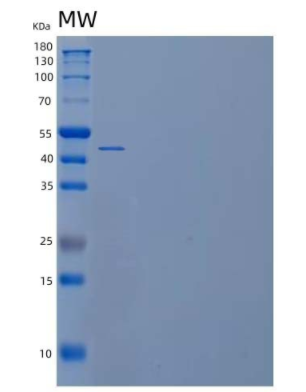 Recombinant Human Selenophosphate Synthase 1/SEPHS1 Protein(C-6His),Recombinant Human Selenophosphate Synthase 1/SEPHS1 Protein(C-6His)