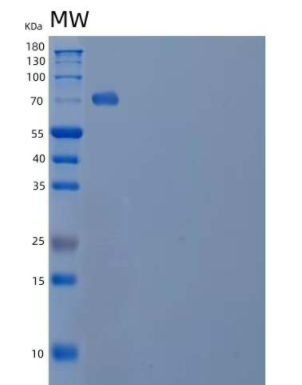 Recombinant Human Semaphorin-4B/SEMA4B Protein(C-6His),Recombinant Human Semaphorin-4B/SEMA4B Protein(C-6His)