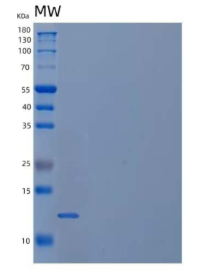 Recombinant Human Follitropin Subunit β/FSHB Protein(C-6His),Recombinant Human Follitropin Subunit β/FSHB Protein(C-6His)