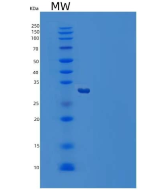 Recombinant Human M-CSF/CSF1 Protein(C-6His),Recombinant Human M-CSF/CSF1 Protein(C-6His)