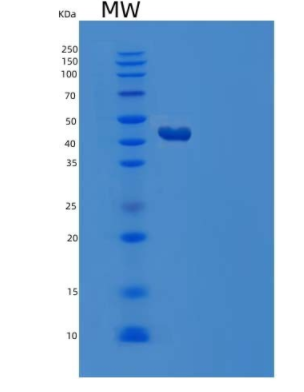 Recombinant Human Serpin A4/Kallistatin Protein(C-6His),Recombinant Human Serpin A4/Kallistatin Protein(C-6His)