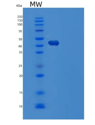 Recombinant Human Serpin A5/Protein C Inhibitor Protein(C-6His),Recombinant Human Serpin A5/Protein C Inhibitor Protein(C-6His)