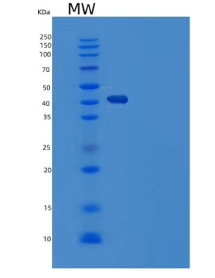 Recombinant Human Serpin F1/PEDF Protein(C-6His),Recombinant Human Serpin F1/PEDF Protein(C-6His)