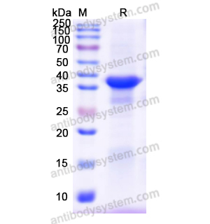 重組SERPINA5蛋白,Recombinant Human SERPINA5, N-His