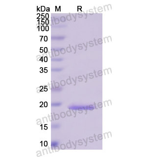 重組PCCA蛋白,Recombinant Human PCCA, N-His