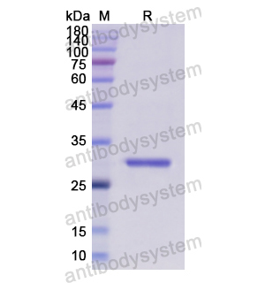 重組EIF2S1蛋白,Recombinant Human EIF2S1, N-His