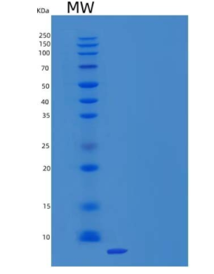 Recombinant Mouse C-C motif chemokine 2/CCL2 Protein,Recombinant Mouse C-C motif chemokine 2/CCL2 Protein