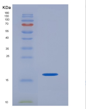 Recombinant Human ISG15 / G1P2 Protein,Recombinant Human ISG15 / G1P2 Protein