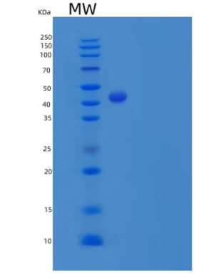 Recombinant Human IL17B / IL-17B Protein (Fc Tag),Recombinant Human IL17B / IL-17B Protein (Fc Tag)