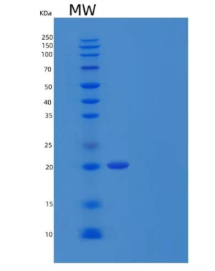 Recombinant Human IL6 / Interleukin-6 Protein,Recombinant Human IL6 / Interleukin-6 Protein