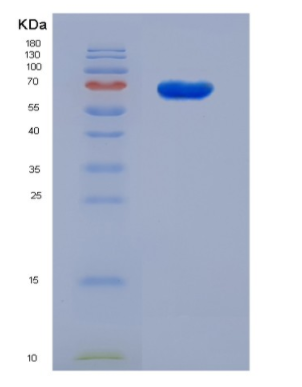 Recobinant Mouse IGFBP-2 / IGFBP2 Protein (Fc Tag),Recobinant Mouse IGFBP-2 / IGFBP2 Protein (Fc Tag)