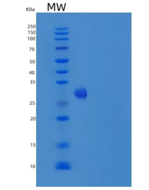 Recombinant Mouse R-Spondin 1 / RSPO1 Protein (His tag),Recombinant Mouse R-Spondin 1 / RSPO1 Protein (His tag)