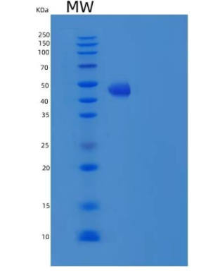 Recombinant Human TL1A Protein (Fc Tag),Recombinant Human TL1A Protein (Fc Tag)