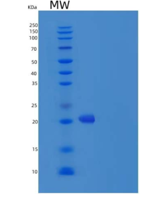 Recombinant Human IFNA4 Protein (His Tag),Recombinant Human IFNA4 Protein (His Tag)