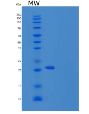 Recombinant Human TNFSF14 / LIGHT / CD258 Protein (His tag),Recombinant Human TNFSF14 / LIGHT / CD258 Protein (His tag)