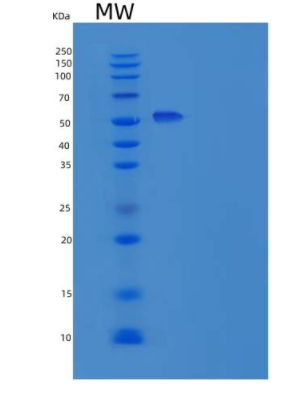 Recombinant Human IL12RB1 Protein (His Tag),Recombinant Human IL12RB1 Protein (His Tag)