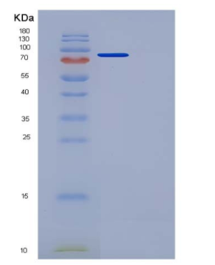 Recombinant Mouse Semaphorin 3A / SEMA3A Protein (Fc tag),Recombinant Mouse Semaphorin 3A / SEMA3A Protein (Fc tag)