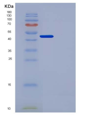 Recombinant Human Urokinase / uPA Protein (His Tag),Recombinant Human Urokinase / uPA Protein (His Tag)