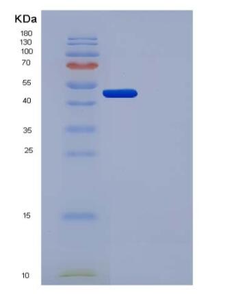 Recombinant Human Urokinase / PLAU Protein (His tag),Recombinant Human Urokinase / PLAU Protein (His tag)