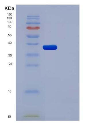 Recombinant Human AKR1A1 Protein (His tag),Recombinant Human AKR1A1 Protein (His tag)