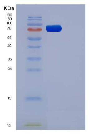 Recombinant Rat VEGFR1 / FLT-1 Protein (His tag),Recombinant Rat VEGFR1 / FLT-1 Protein (His tag)