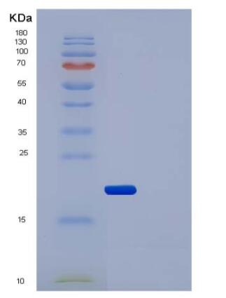 Recombinant Human IL2Ra / CD25 Protein (His tag),Recombinant Human IL2Ra / CD25 Protein (His tag)