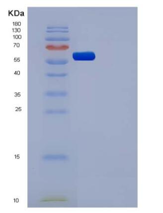 Recombinant Human CSF1R / MCSF Receptor / CD115 Protein (His tag),Recombinant Human CSF1R / MCSF Receptor / CD115 Protein (His tag)