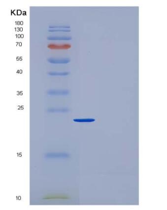 Recombinant Rat CRP / C-Reactive Protein (His tag),Recombinant Rat CRP / C-Reactive Protein (His tag)