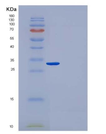 Recombinant Human CUTC / CGI-32 Protein (His tag),Recombinant Human CUTC / CGI-32 Protein (His tag)