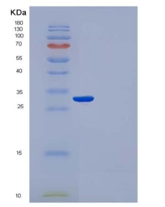 Recombinant Human IgG1 Fc Protein,Recombinant Human IgG1 Fc Protein